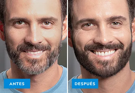 real guys before and after