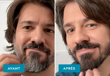 Mustache & Beard before & after
