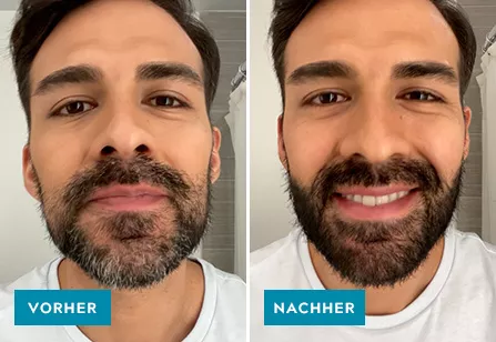 Mustache & Beard before & after