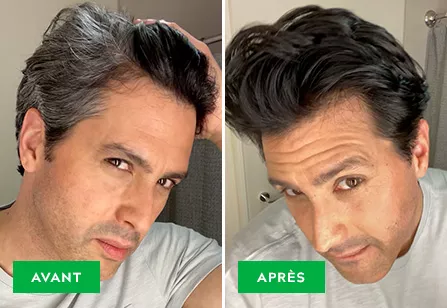 Before & After image