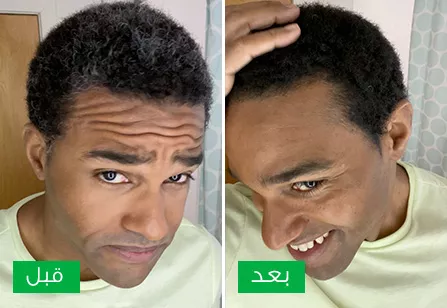 Before & After image