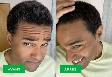 Before & After image