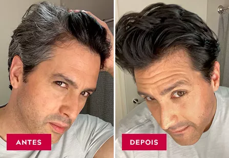 Before & After image