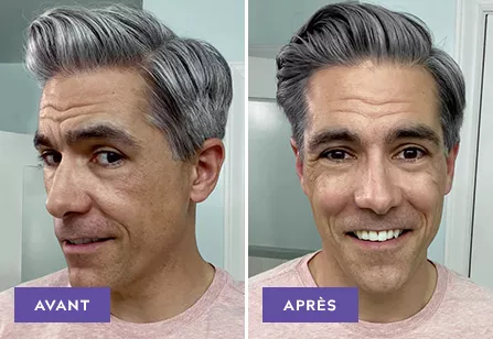 Touch Of Gray results: before and after