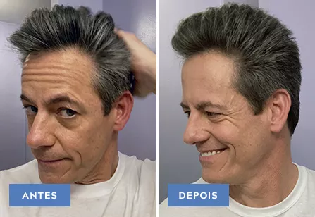 Touch Of Gray results: before and after