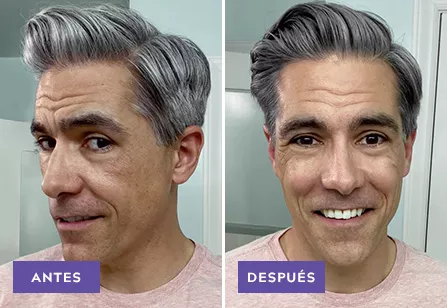 Touch Of Gray results: before and after